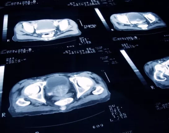 MRI-Scan-of-Abdomen