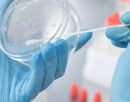 Blue sterile gloves holding a petri dish