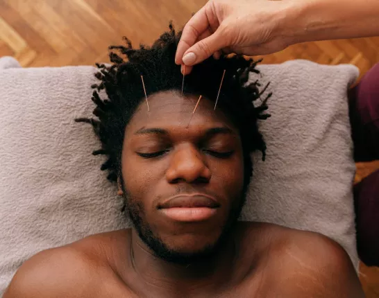 A Person Inserting Needles on a Man's Forehead