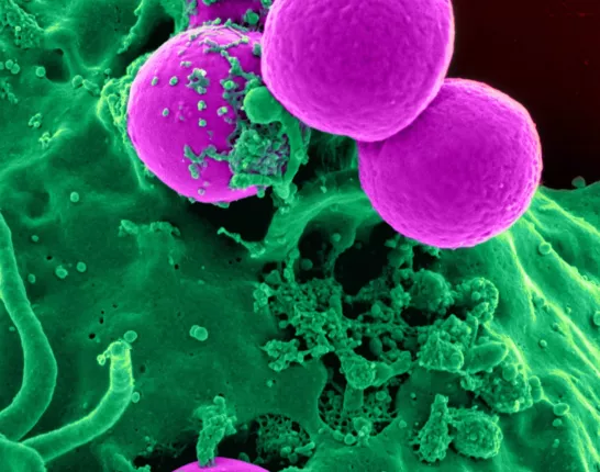 Cell like structure