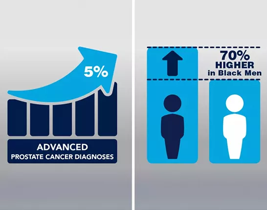 Advanced Prostate cancer diagnoses higher in black men