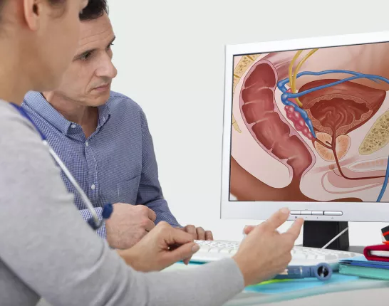 A man and a doctor looking at a computer screen with a diagram of a prostate