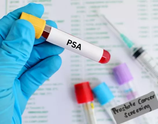 Medical gloved hand with blood test tube for PSA test
