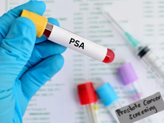 Medical gloved hand with blood test tube for PSA test