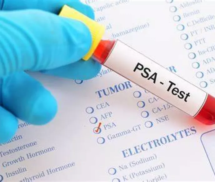 PSA test