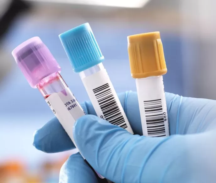 How Patients with Metastatic Prostate Cancer Can Be Informed By Biomarker Testing