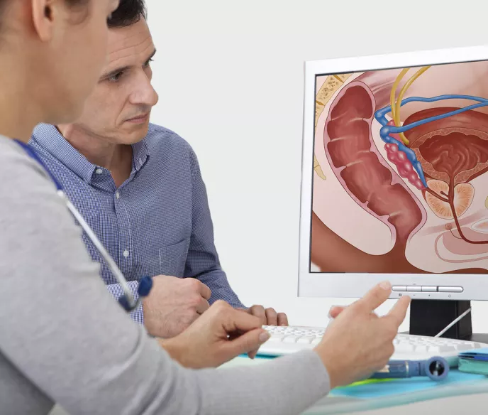 A man and a doctor looking at a computer screen with a diagram of a prostate