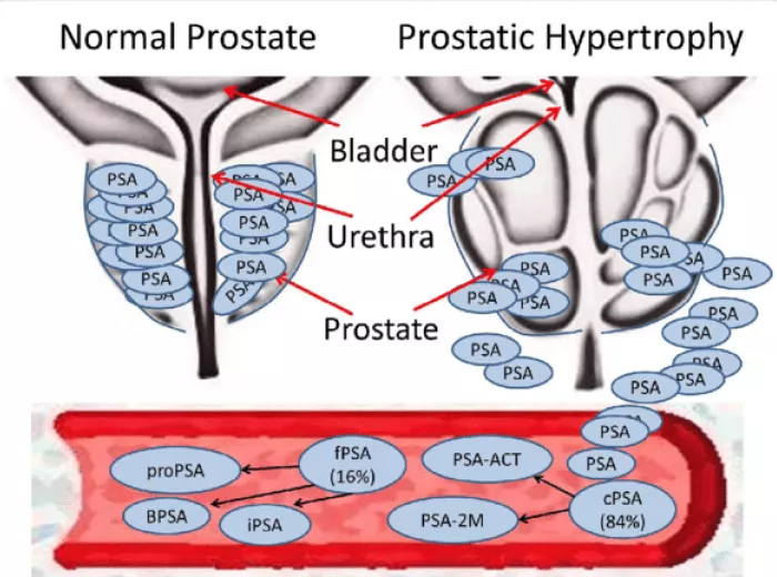 Prostate-specific antigen