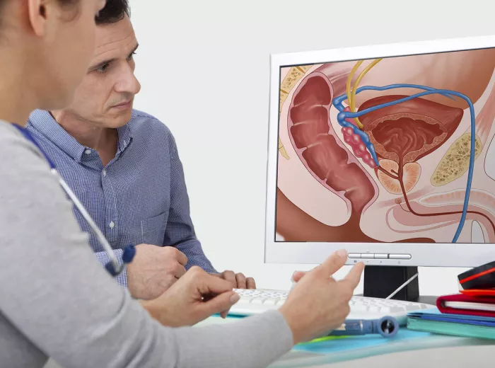 A man and a doctor looking at a computer screen with a diagram of a prostate