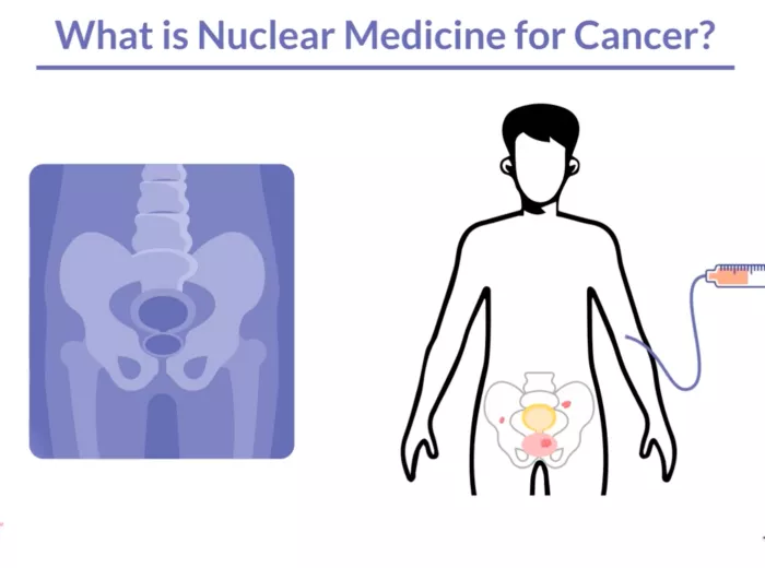 What Is Nuclear Medicine for Cancer? Video