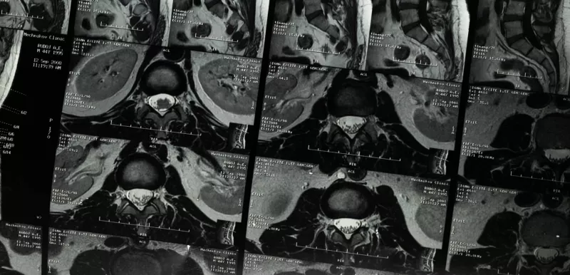Black and white imaging scans of bones