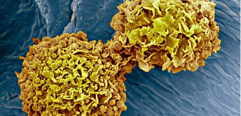 Cancer Blood Test Enormously Exciting From Science Photo Library