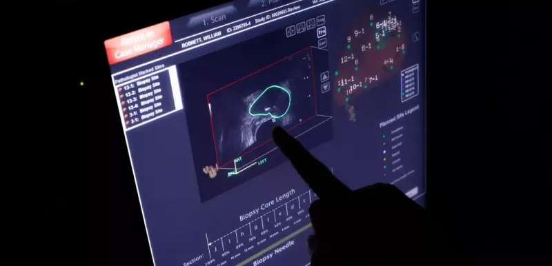 Pointing to a scan of prostate cancer patient screen