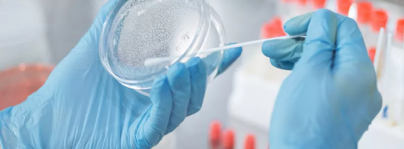 Blue sterile gloves holding a petri dish