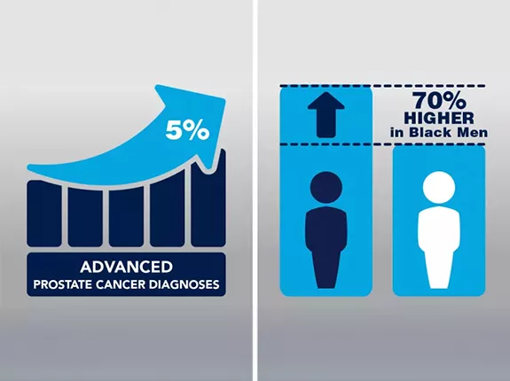 Advanced Prostate cancer diagnoses higher in black men