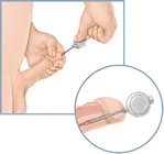 A drawing of a suppository for treating erectile dysfunction