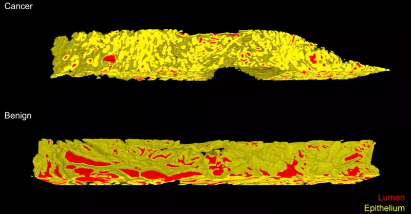 3D imaging of cancer