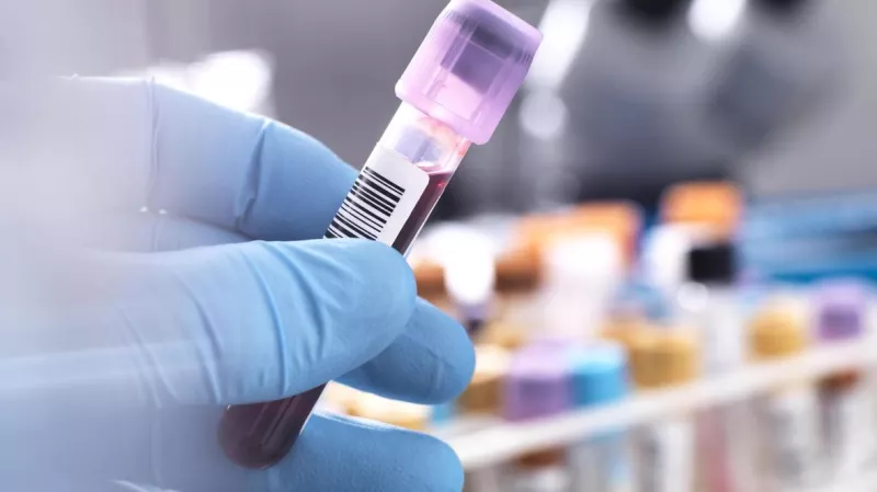 Medical staff with blue gloves holding a vial with blood