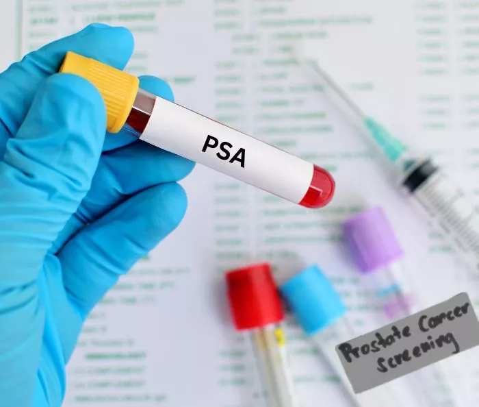 Medical gloved hand with blood test tube for PSA test